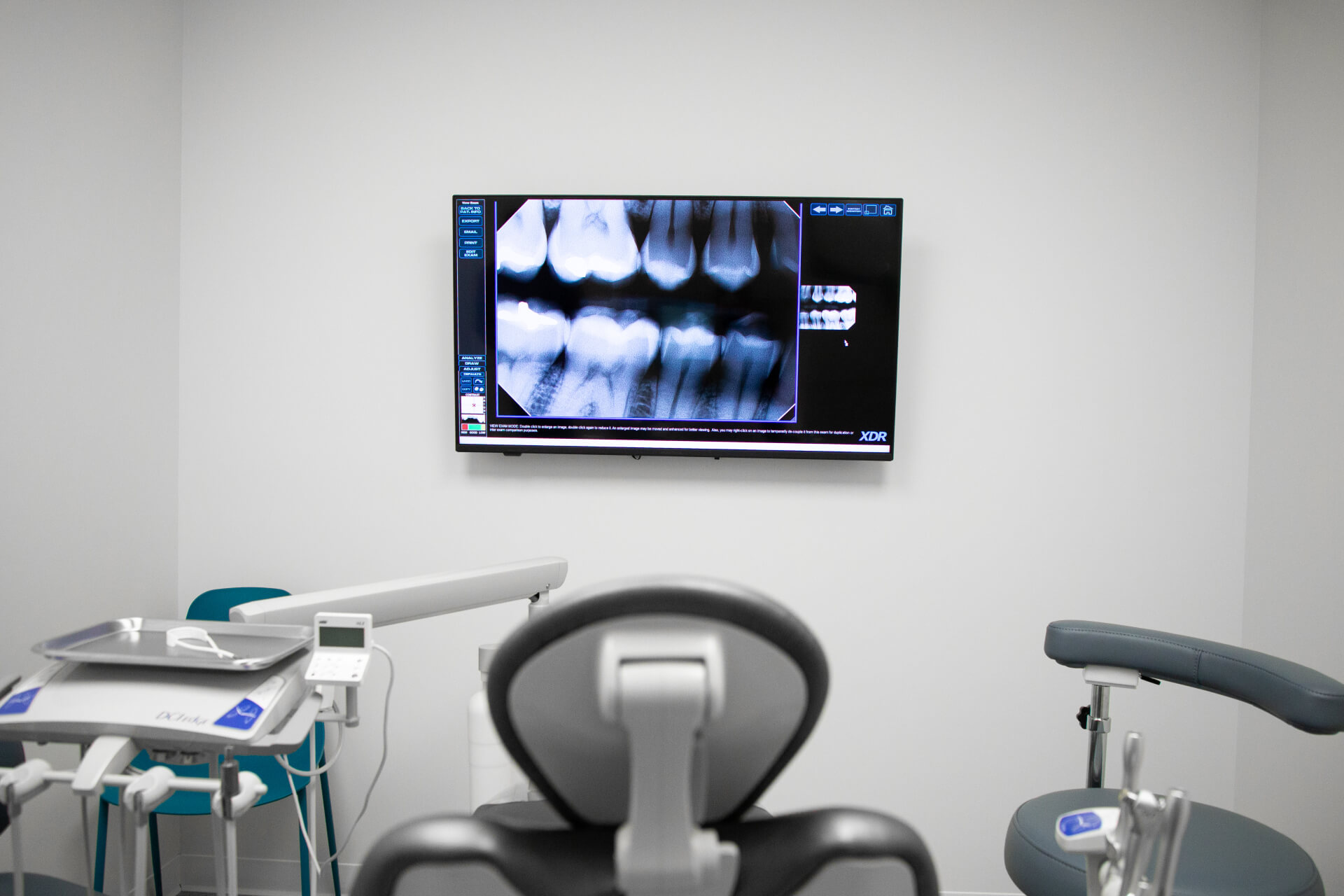 Sedation Options in Lewis Center, OH Refine Dental Studio